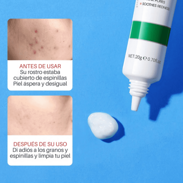 CREMA PARA CICATRICES - Imagen 3