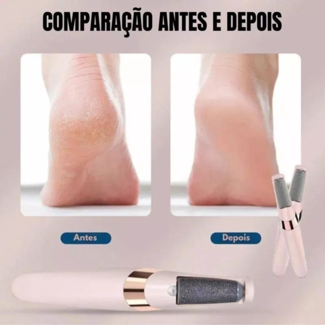 REMOVEDOR DE CALLOS PARA PIES - Imagen 4